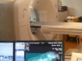 Research Into Position of Pulp Chamber (no.6) in the Second Premolars