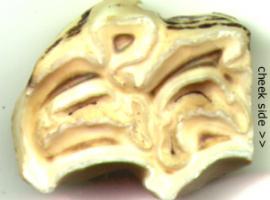 Upper Molar Occlusal Surface